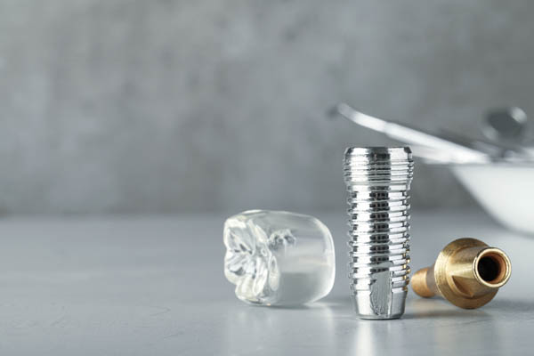 Three Benefits Of Dental Implants