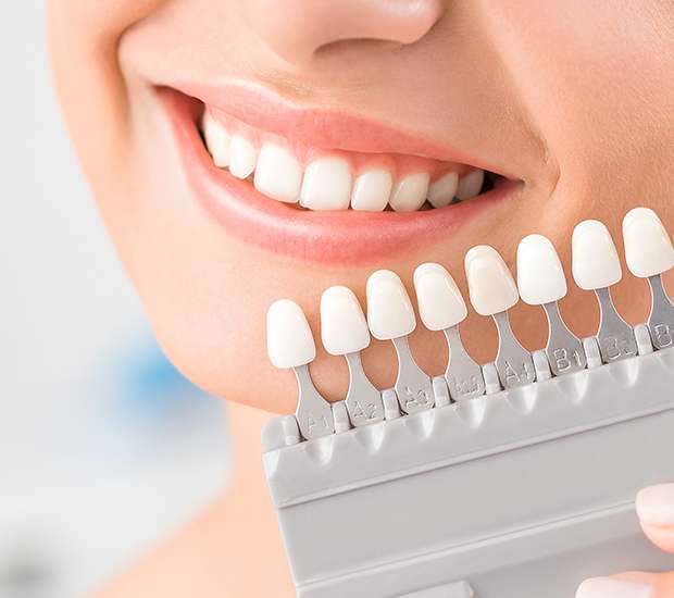 Conway Dental Veneers and Dental Laminates