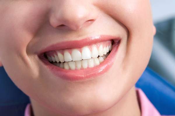 A General Dentist Discusses the Benefits of Tooth Straightening from Adlong Dental in Conway, AR
