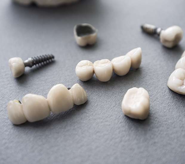 Conway The Difference Between Dental Implants and Mini Dental Implants